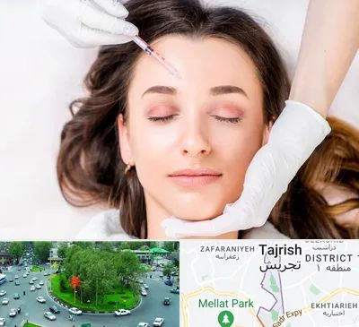 مزوتراپی ابرو در تجریش 