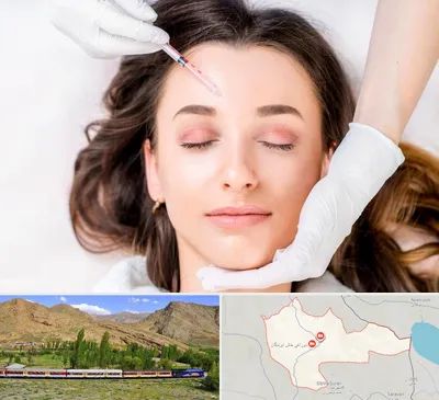 مزوتراپی ابرو در خاش