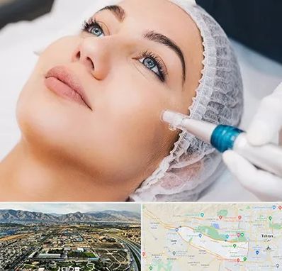 مزونیدلینگ در منطقه 21 تهران 