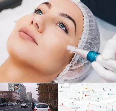 مزونیدلینگ در کارگر شمالی 