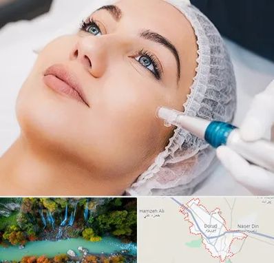 مزونیدلینگ در دورود