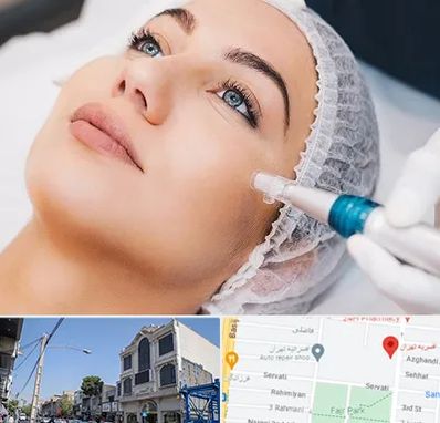 مزونیدلینگ در افسریه 