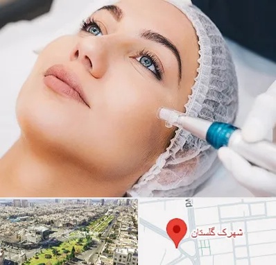 مزونیدلینگ در شهرک گلستان