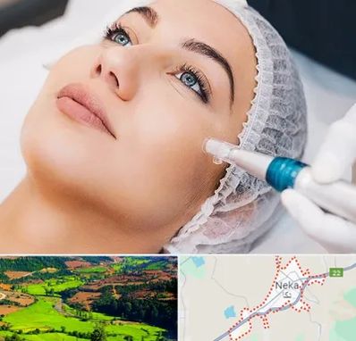 مزونیدلینگ در نکا