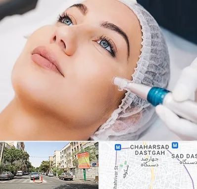 مزونیدلینگ در چهارصد دستگاه 