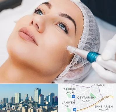 مزونیدلینگ در قیطریه 