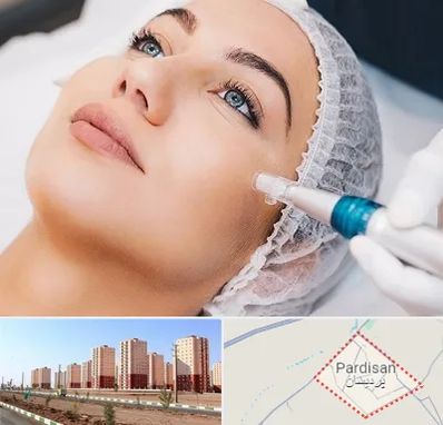 مزونیدلینگ در پردیسان قم