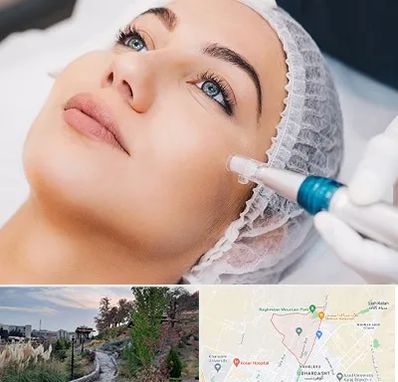 مزونیدلینگ در باغستان کرج