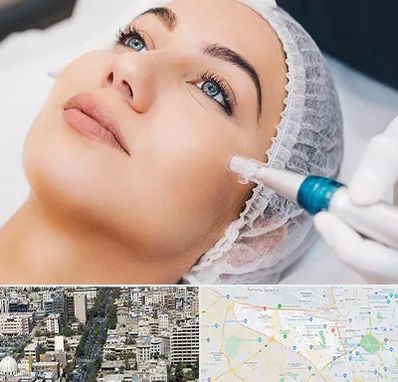 مزونیدلینگ در منطقه 18 تهران 