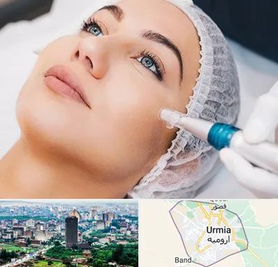 مزونیدلینگ در ارومیه