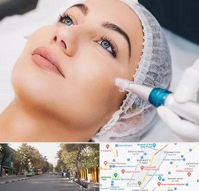 مزونیدلینگ در شریعتی 