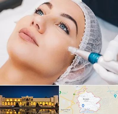 مزونیدلینگ در برازجان