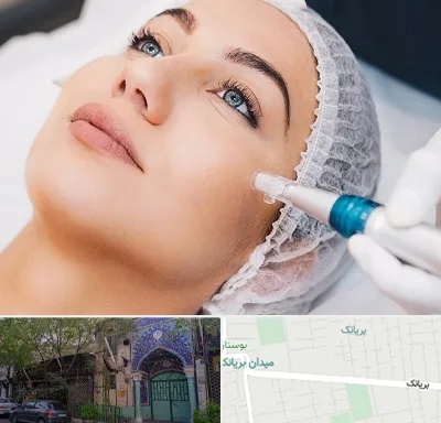 مزونیدلینگ در بریانک