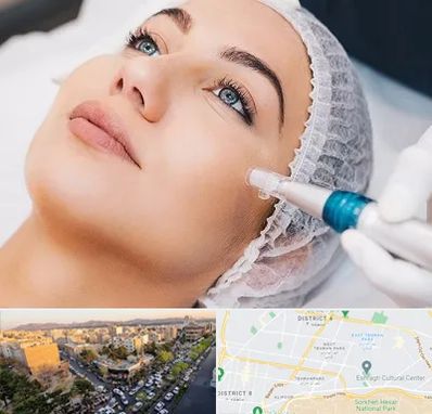 مزونیدلینگ در تهرانپارس 