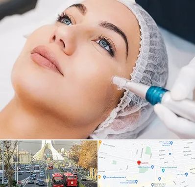 مزونیدلینگ در خیابان آزادی 