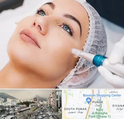 مزونیدلینگ در پونک 