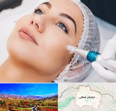 مزونیدلینگ در خراسان شمالی