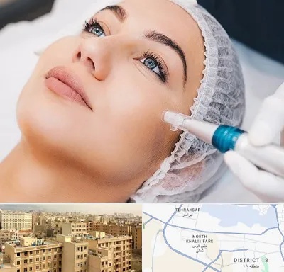 مزونیدلینگ در جنوب غرب تهران