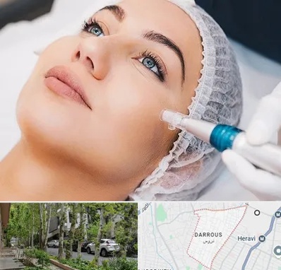 مزونیدلینگ در دروس