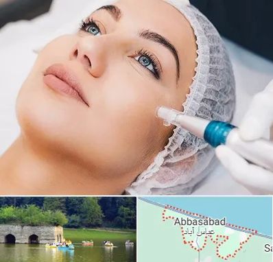 مزونیدلینگ در عباس آباد