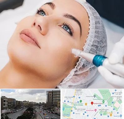 مزونیدلینگ در بلوار فردوسی مشهد