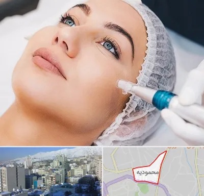 مزونیدلینگ در محمودیه