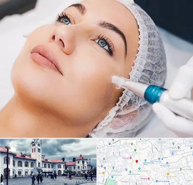 مزونیدلینگ در میدان شهرداری رشت