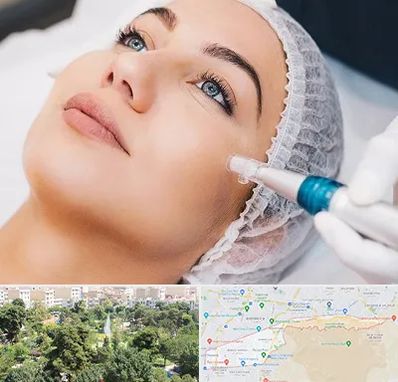 مزونیدلینگ در منطقه 13 تهران 