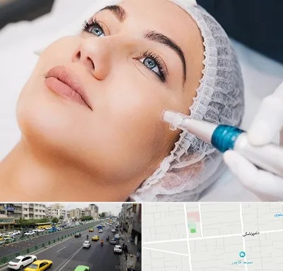 مزونیدلینگ در خیابان دامپزشکی