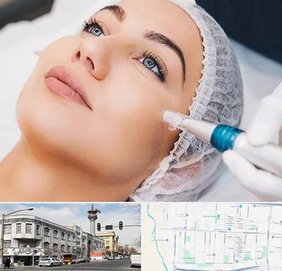 مزونیدلینگ در 17شهریور