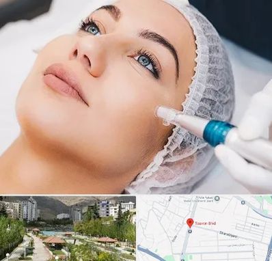 مزونیدلینگ در بلوار تعاون