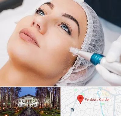 مزونیدلینگ در باغ فردوس