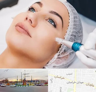 مزونیدلینگ در میدان خراسان