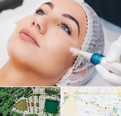 مزونیدلینگ در وکیل آباد مشهد