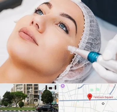 مزونیدلینگ در میدان فردوسی تهران