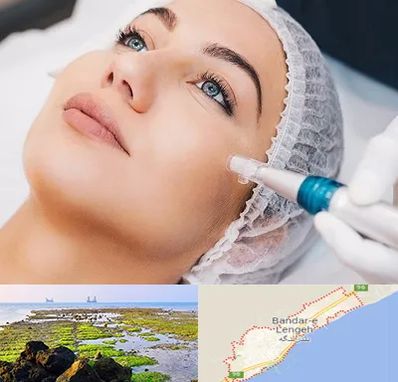 مزونیدلینگ در بندرلنگه