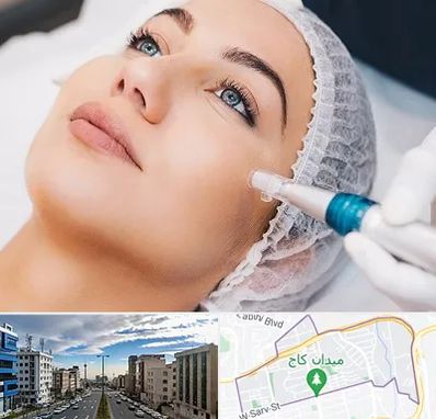 مزونیدلینگ در سعادت آباد 