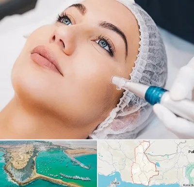 مزونیدلینگ در سیستان و بلوچستان