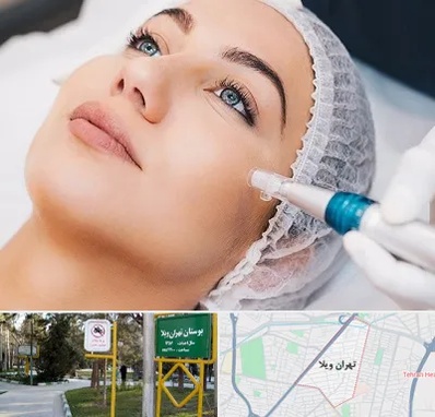 مزونیدلینگ در تهران ویلا