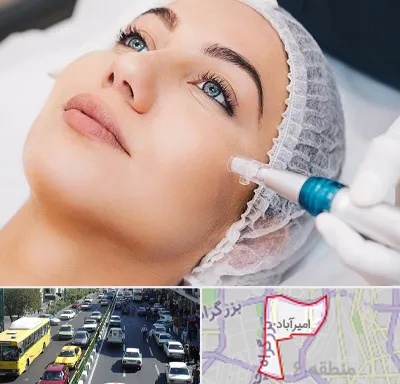 مزونیدلینگ در امیرآباد