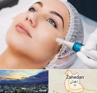 مزونیدلینگ در زاهدان