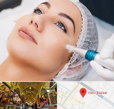 مزونیدلینگ در بازار وکیل شیراز