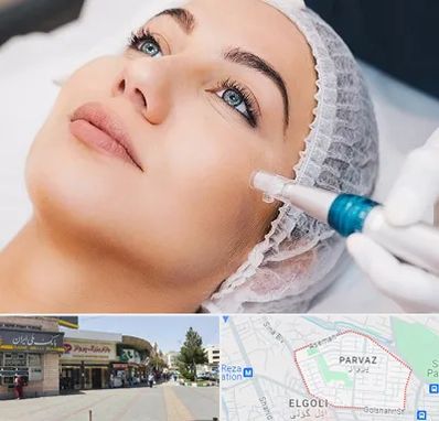 مزونیدلینگ در پرواز تبریز