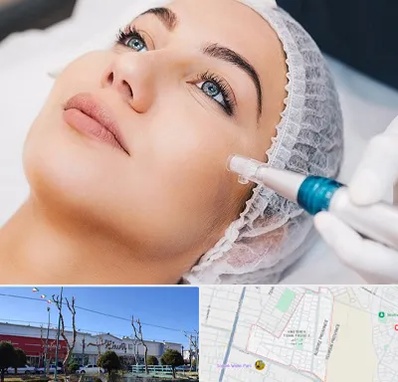 مزونیدلینگ در فاز دو اندیشه