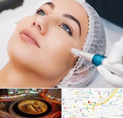 مزونیدلینگ در میدان ولیعصر 