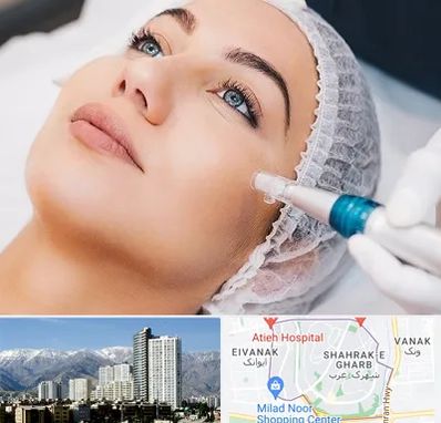 مزونیدلینگ در شهرک غرب 