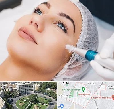 مزونیدلینگ در جهانشهر کرج 