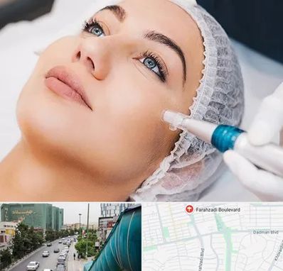 مزونیدلینگ در بلوار فرحزادی