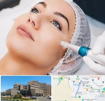 مزونیدلینگ در صیاد شیرازی مشهد