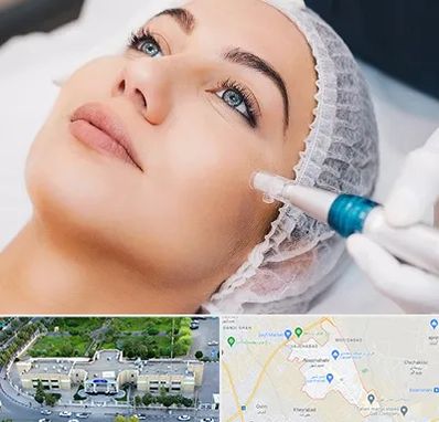 مزونیدلینگ در نسیم شهر